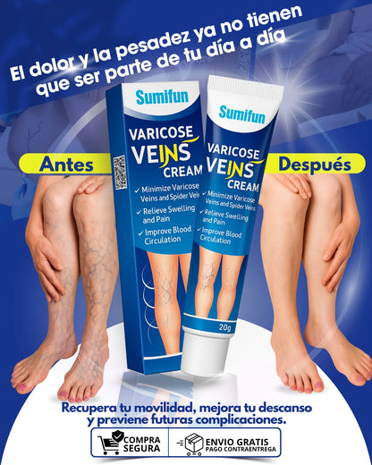 Crema para varices VARICOSE