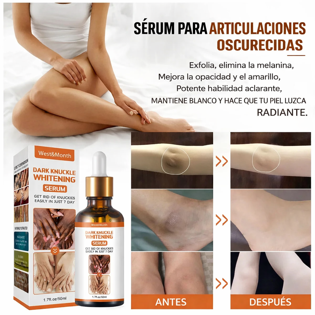 Serum aclarador de nudillos y zonas oscuras – piel más uniforme e iluminada