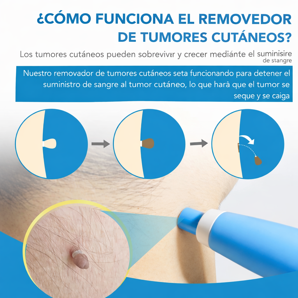 Kit eliminador de verrugas – elimínalas fácilmente desde casa sin complicaciones