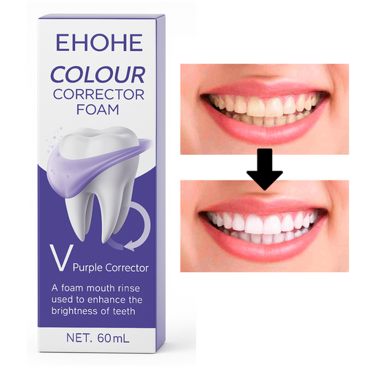 Tratamiento Sonrisa Perfecta 60ML