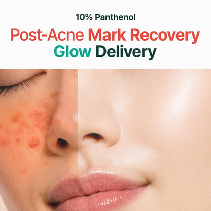 Crema Postacné Panthenol Glow Reparadora
